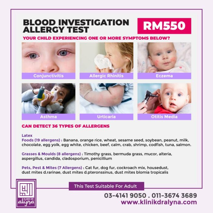 perkhidmatan-rawatan-alahan