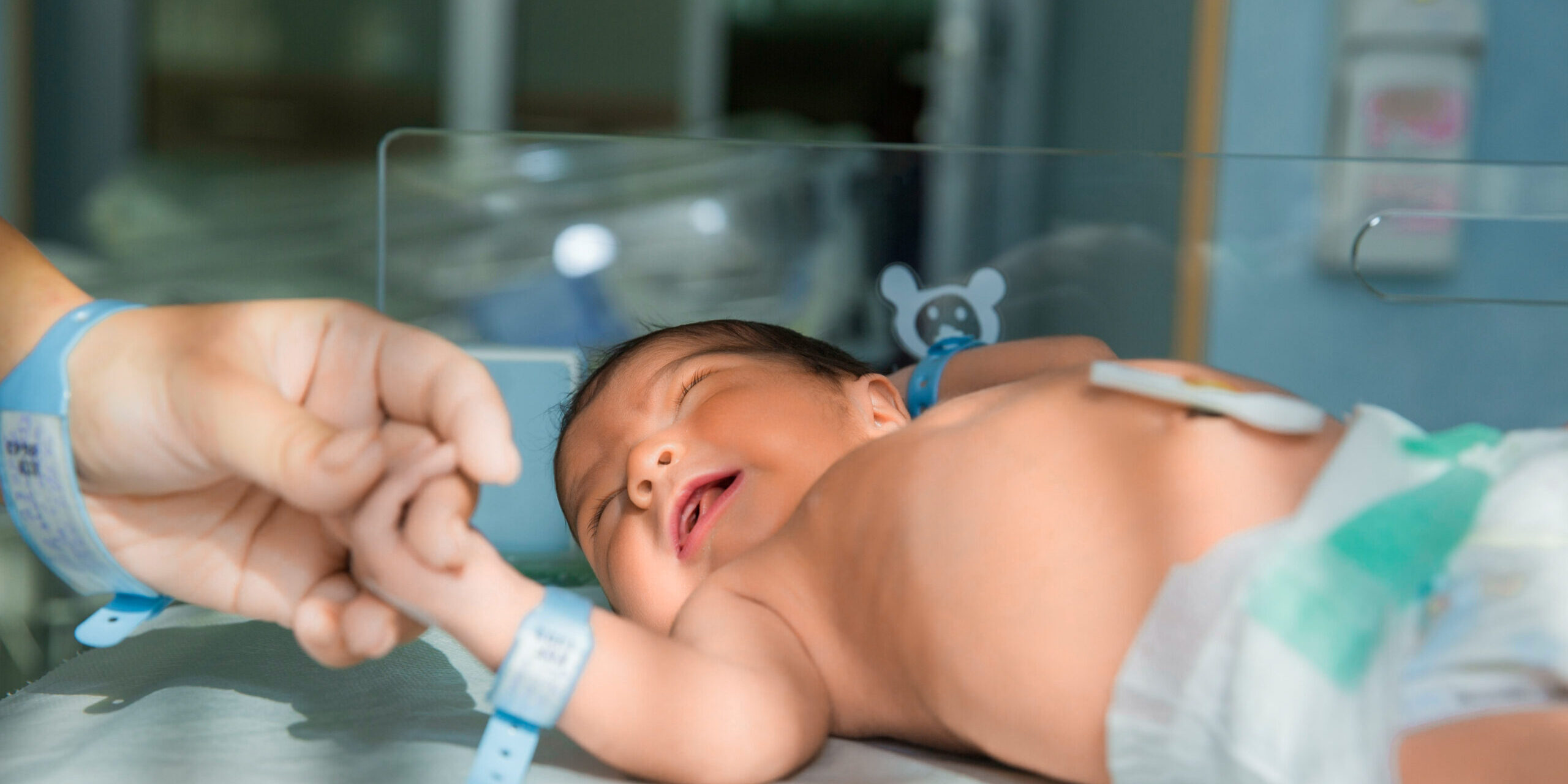 Baby Jaundice sewa lampu phototherapy Check kuning baby