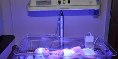 sewa lampu phototheraphy sewa lampu phototheraphy