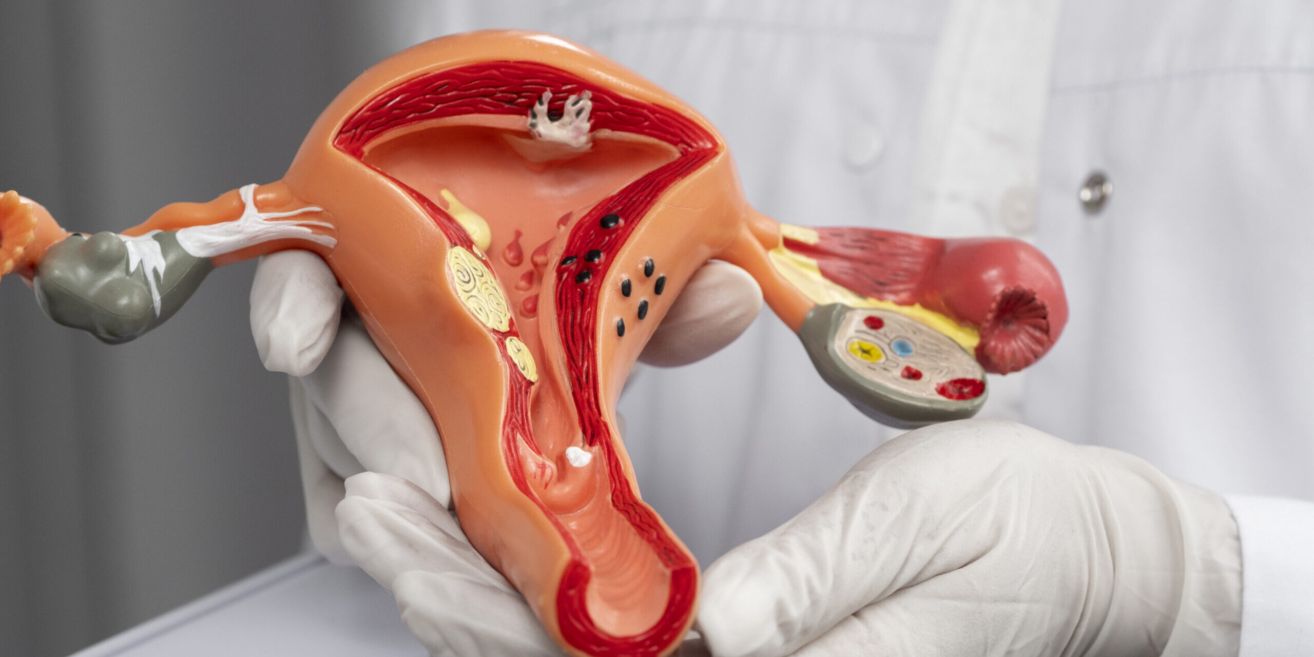 pap smear check-up